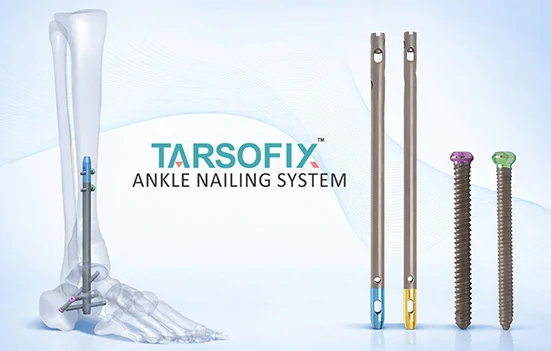 TARSOFIX Ankle Nailing System