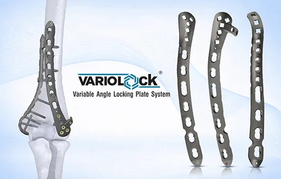 Variolock Elbow Plating System