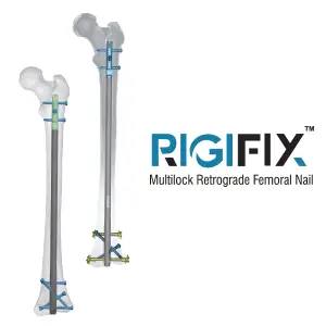 Rigifix Brand Logo