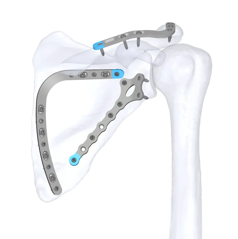 Scapula Locking Plate System