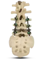 spine front image