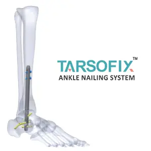 tarsofix brand logo