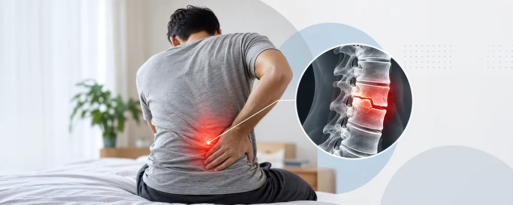 spine fracture